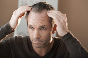 transplante capilar curitiba stress queda de cabelo