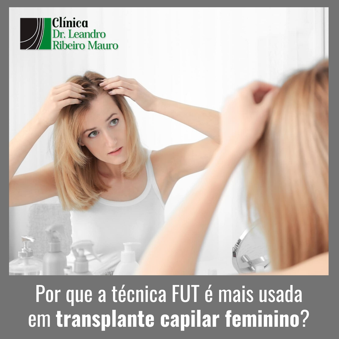 por que a técnica fut é mais usada em transplante capilar feminino