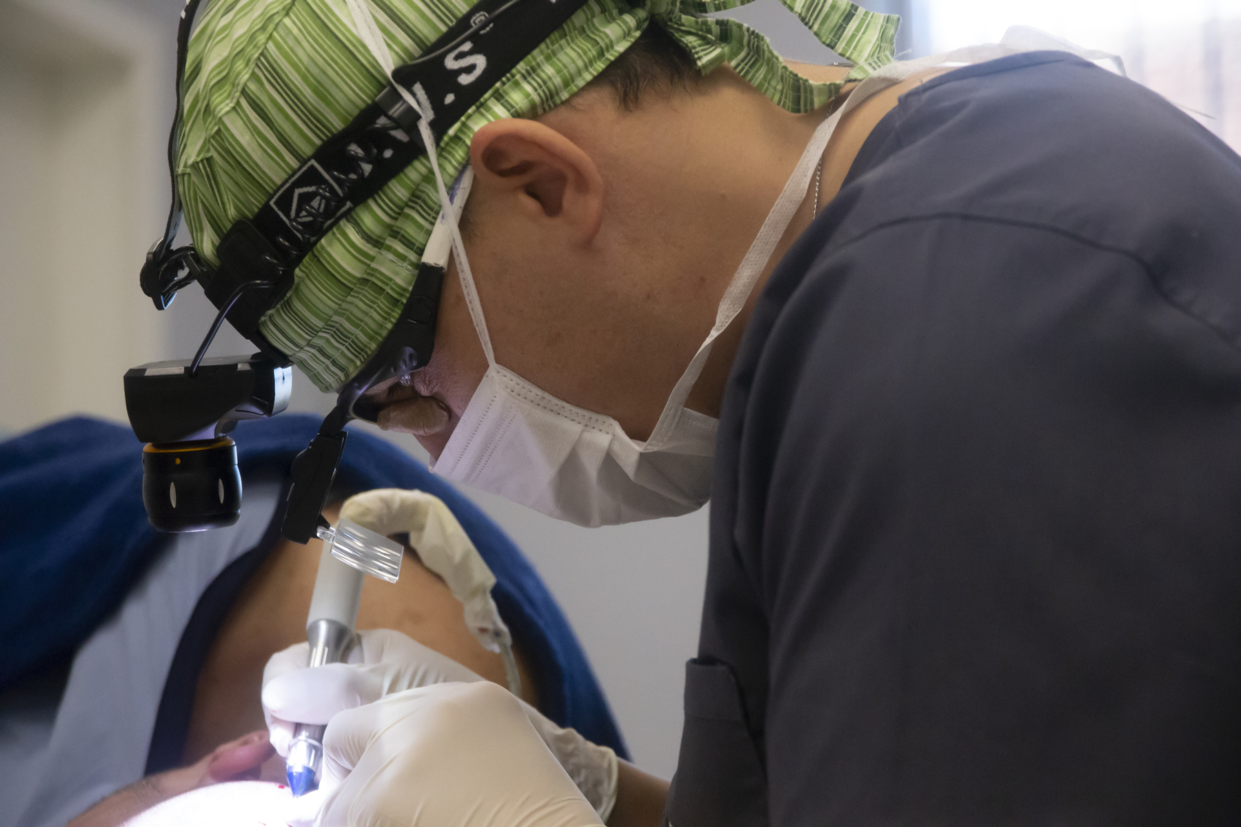 transplante capilar dr leandro mauro curitiba