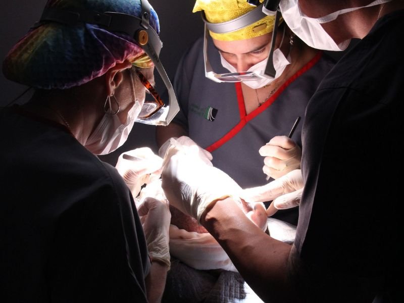 Diferenca entre Implante Capilar e Transplante Capilar em Curitiba